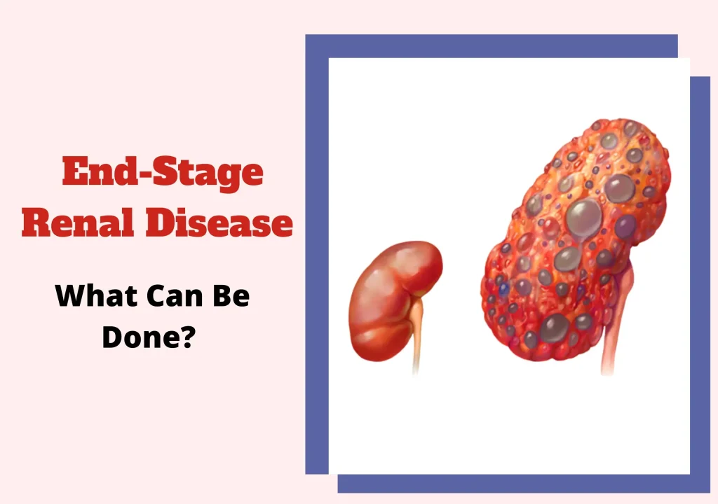 can-end-stage-kidney-disease-be-cured-honjok-me